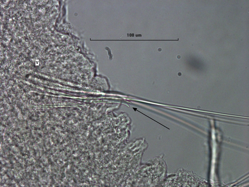 Photomicrograph of worm chaetae showing a combination of long thin hairs and chaetae with two large teeth and minute pectinations in-between.