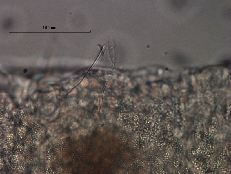 Photomicrograph of part of a worm showing a cone-shaped penis sheath protruding from the body wall.